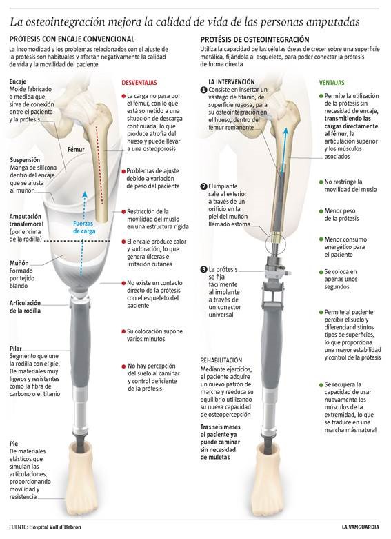 Infográfico de osteointegración