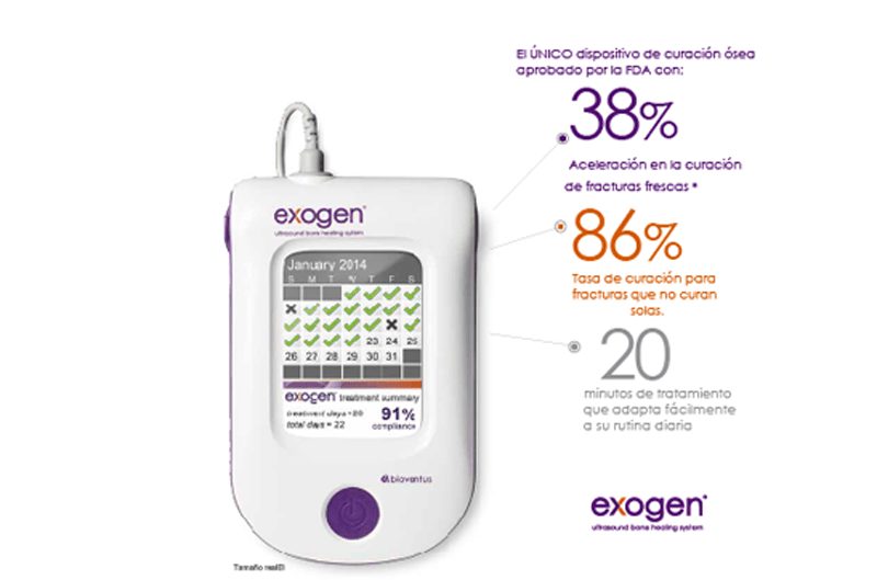Ventajas de Exogen