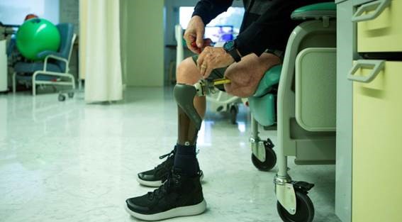 Persona poniéndose la prótesis de osteointegración