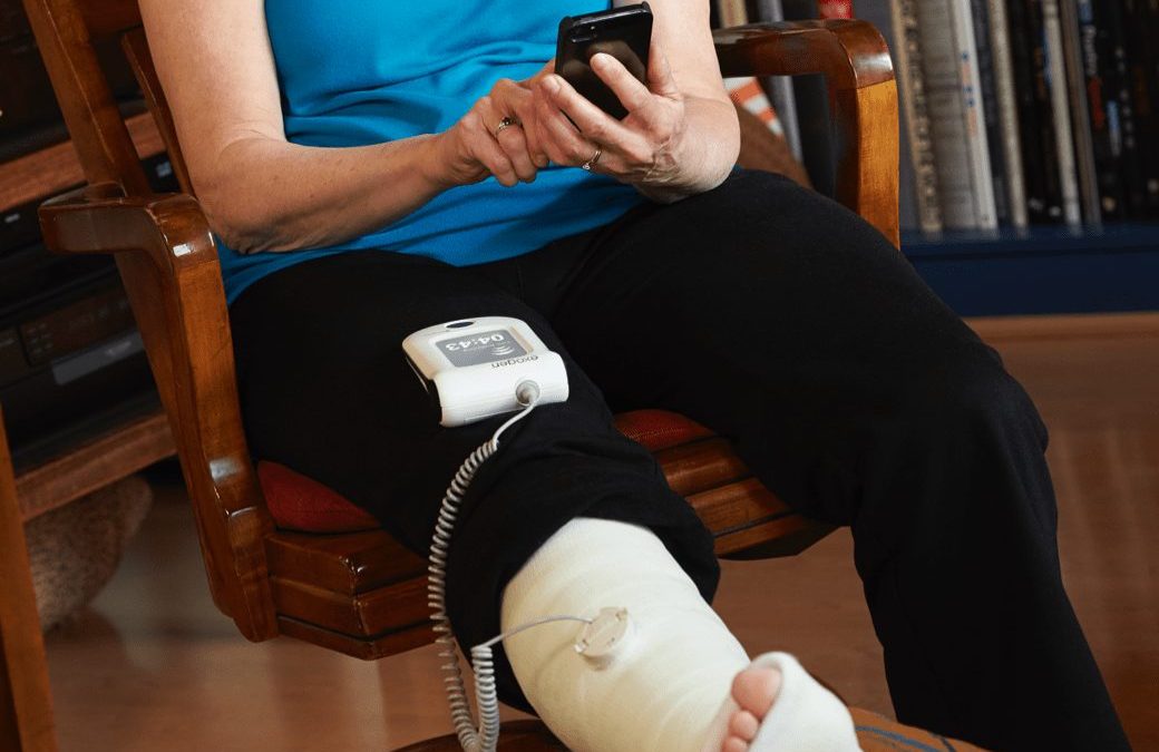 EXOGEN: Cura fracturas más rápidamente