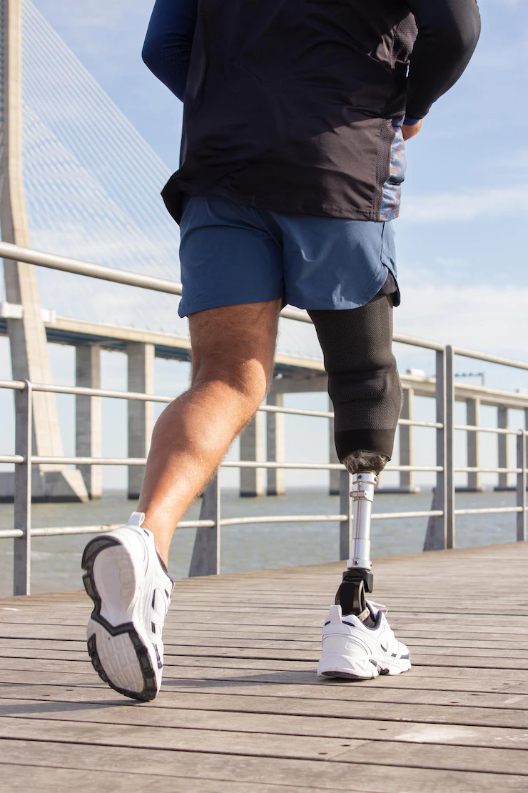 Man with prosthesis running